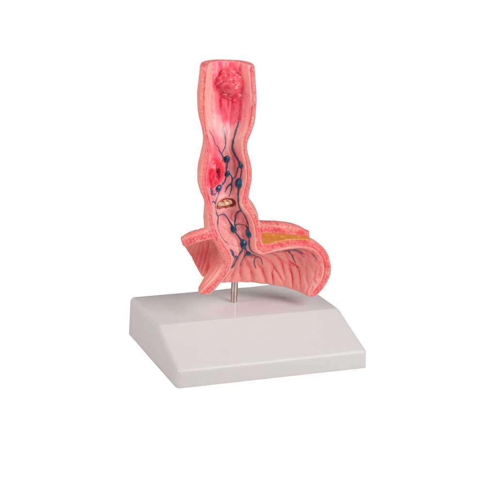 Anatomisches Tischmodell der Speiseröhre mit Rachenansicht