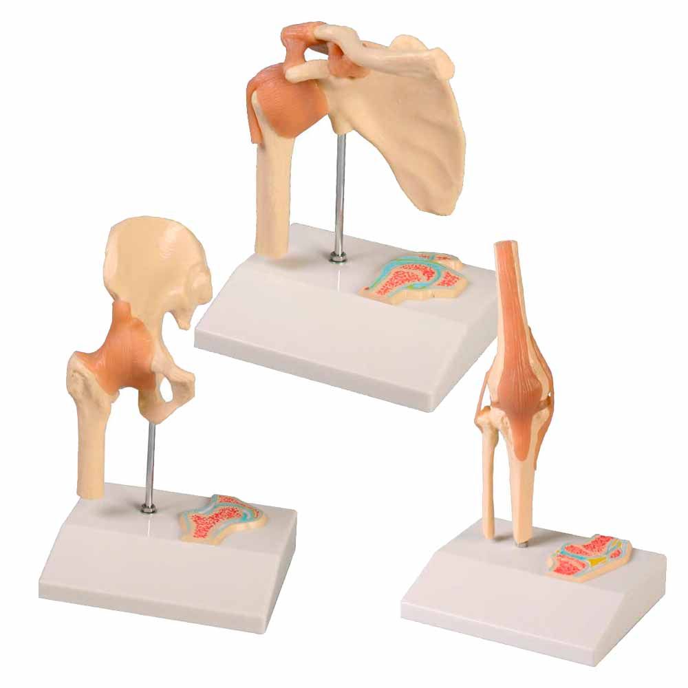 Mini-Gelenkmodell mit Querschnitt: Hüfte, Schulter und Knie auf Sockeln