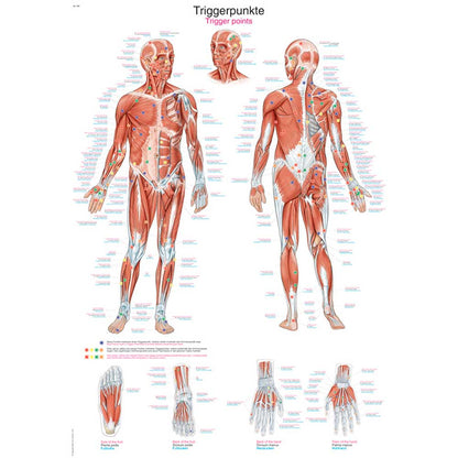 Erler Zimmer anatomische Lehrtafel für Triggerpunkte: Körper- und Extremitäten-Details