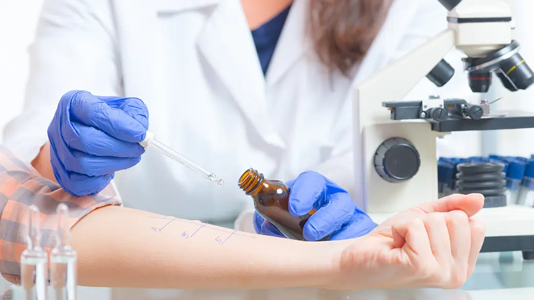 The forearm of a patient is prepared for the prick test by a doctor applying drops of allergens to previously marked skin areas with a pipette