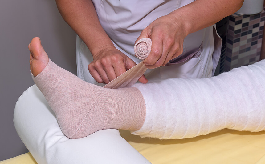 Applying a compression bandage