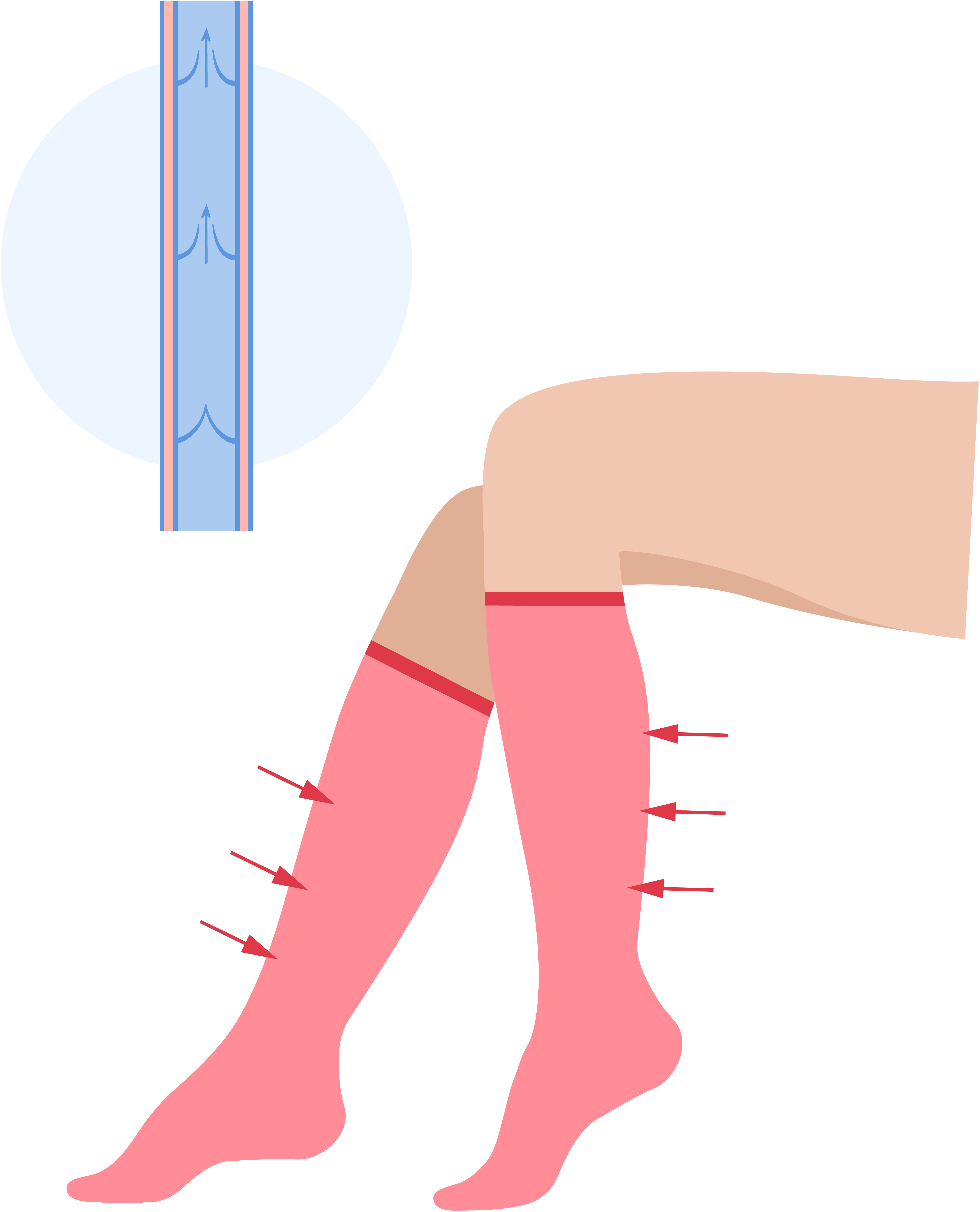 The effect of compression stockings