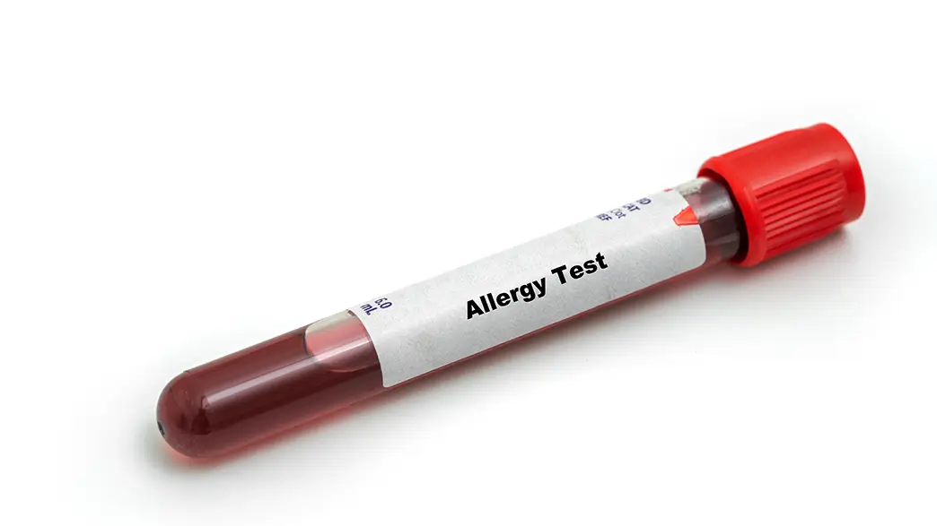 Close-up of a blood sample tube labeled Allergy Test